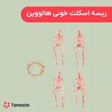 ریسه اسکلت خونی هالووین