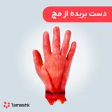 دست بریده از مچ